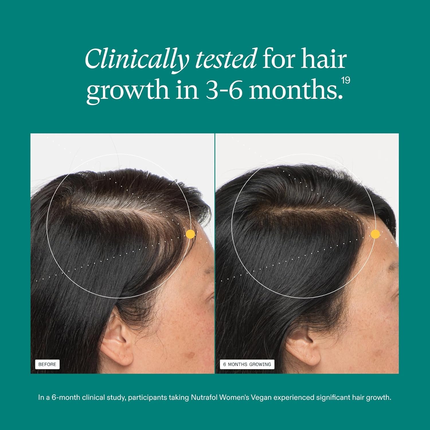 Nutrafol Women’s Balance Hair Growth Supplement – Clinically Proven for Thicker Hair – Ages 45+ 1-Month Supply – Soy-Free Dairy-Free Dermatologist Recommended (6)